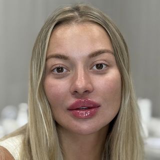После процедуры