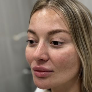 До процедуры