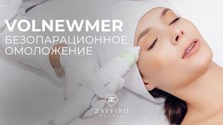 Монополярный RF-лифтинг Volnewmer - безоперационное омоложение