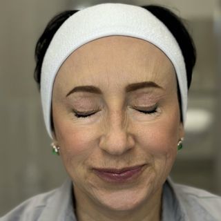 После процедуры